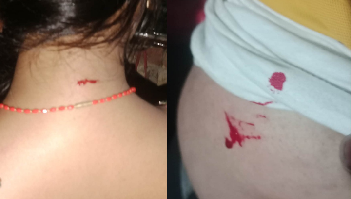 सिमौनगढका अभय दुबे दम्पतीमाथि निर्घात कुटपिट, ज्यान मार्ने धम्की